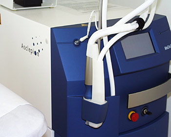 Diodenlaser zur Haarentfernung